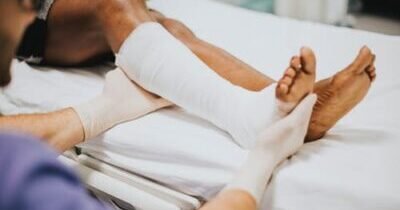 العلاج الطبيعي بعد الكسور